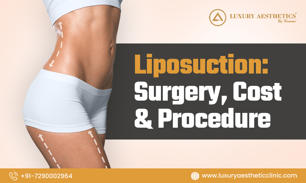 Liposuction: Surgery, Cost & Procedure