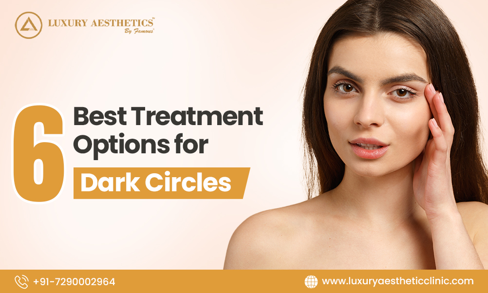 Under Eye Dark Circles: 6 Best Treatment Options for Dark Circles
